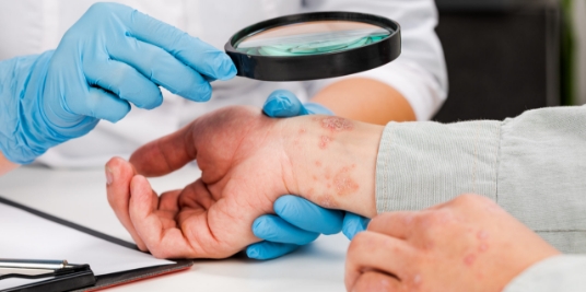 Treatments for medical skin conditions